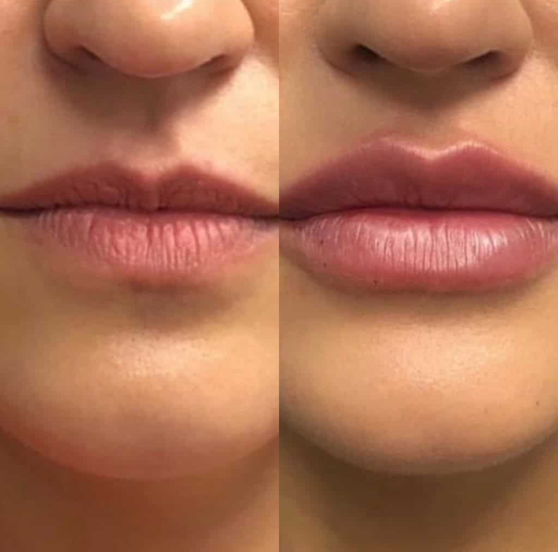 EB9405E2-1A1C-4ACD-8204-305FE020933C-1