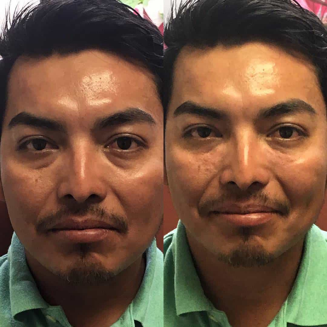 benson_pa_1488315482_1460418575139183367_1121674919 2