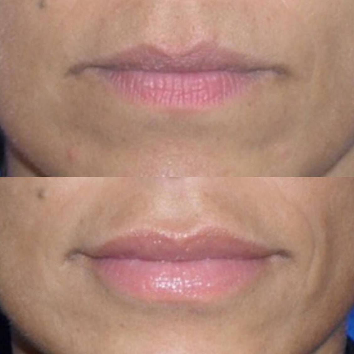 benson_pa_1489194596_1467793117268618061_1121674919 2