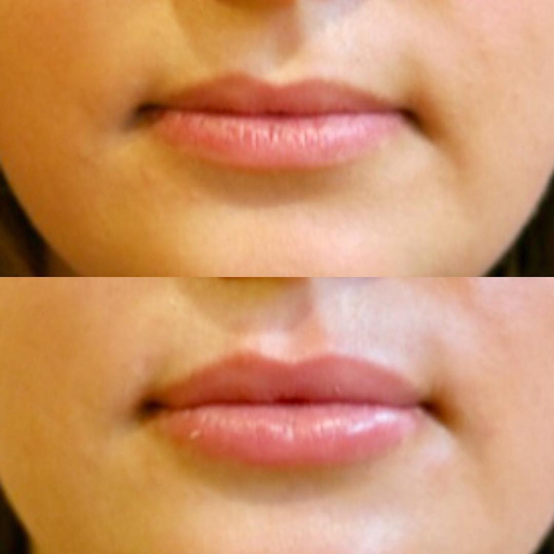 benson_pa_1490128754_1475629403580883924_1121674919 (1)