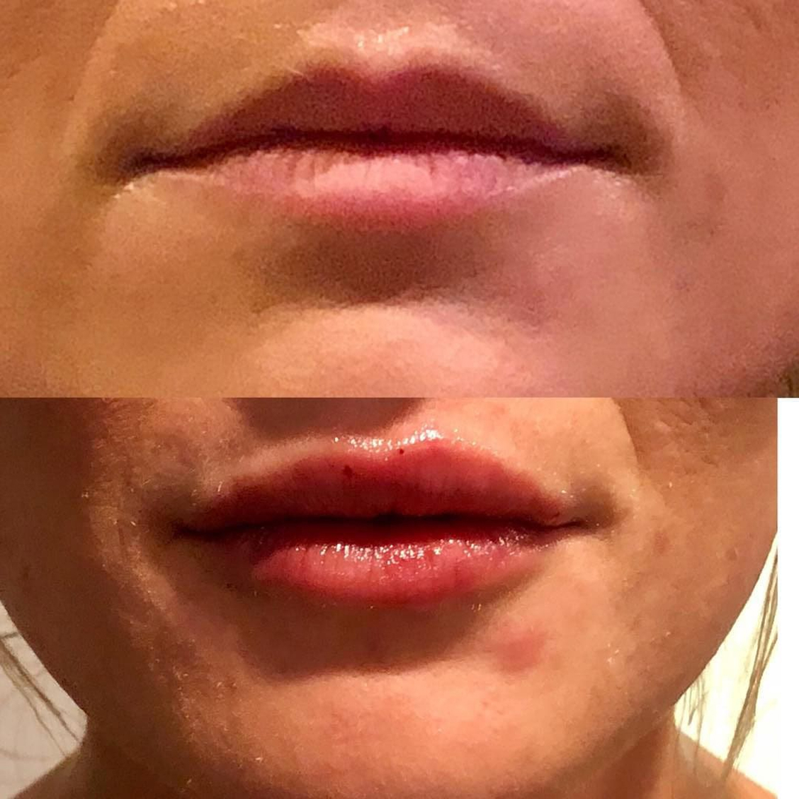 benson_pa_1517280551_1703395187977748106_1121674919