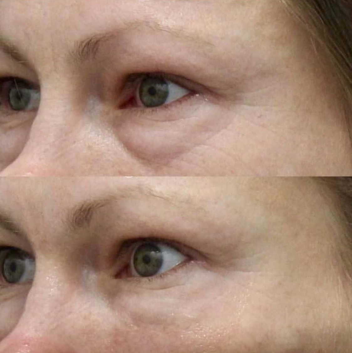 benson_pa_1520272221_1728491129823293466_1121674919 2