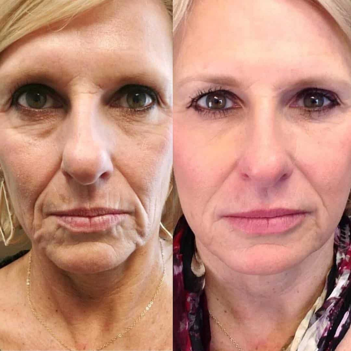 benson_pa_1520292260_1728659229702397847_1121674919 2