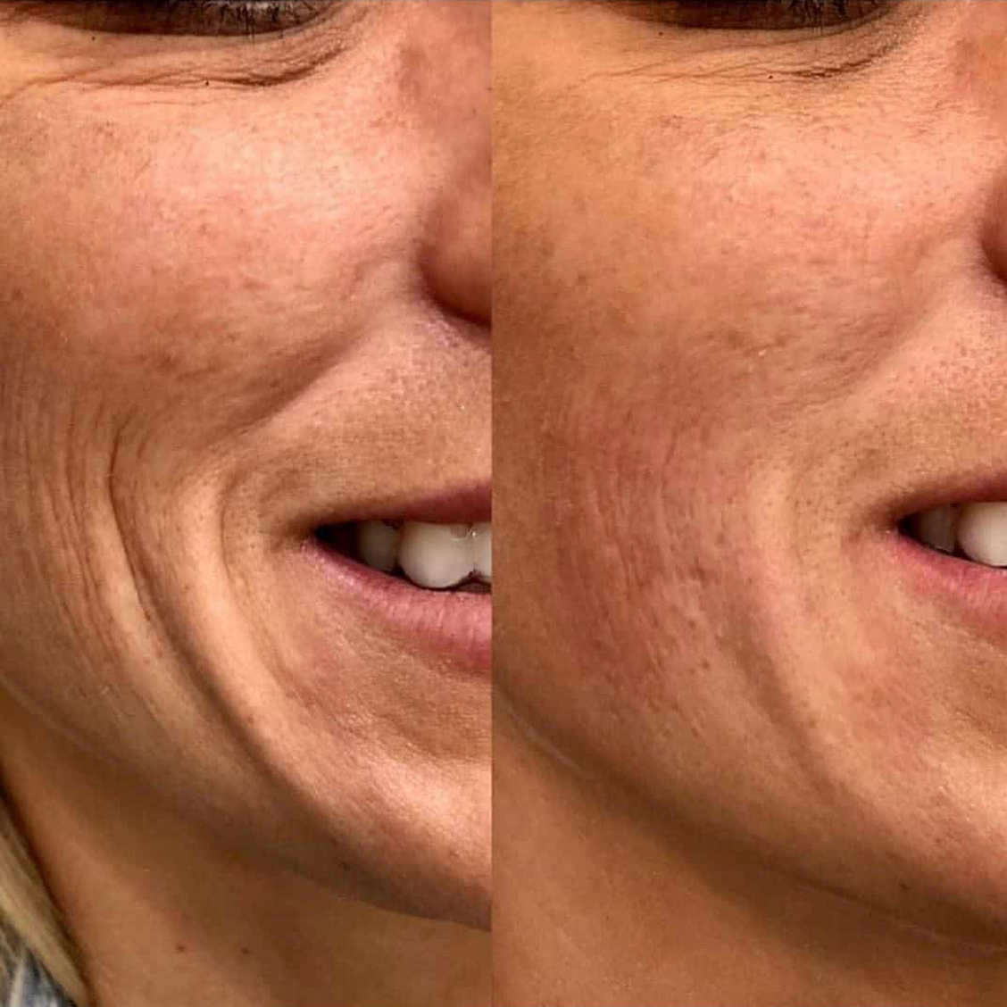 benson_pa_1523835286_1758380284875045888_1121674919-1 2