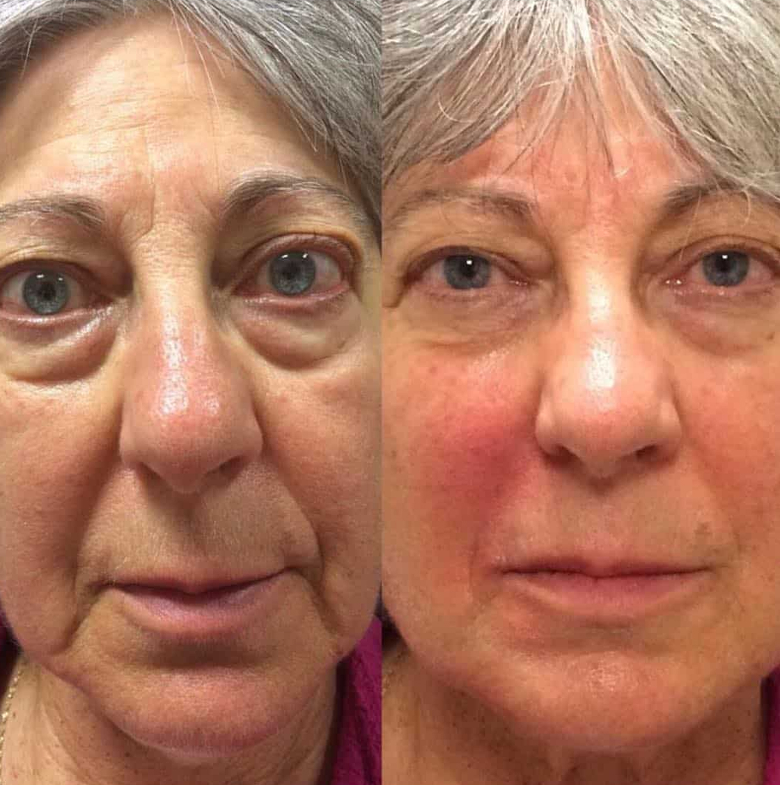 benson_pa_1539618887_1890782727650086211_1121674919 2