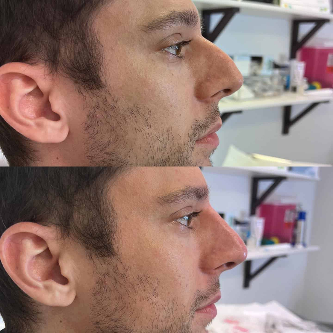 benson_pa_1648852271_2807098770418375867_1121674919