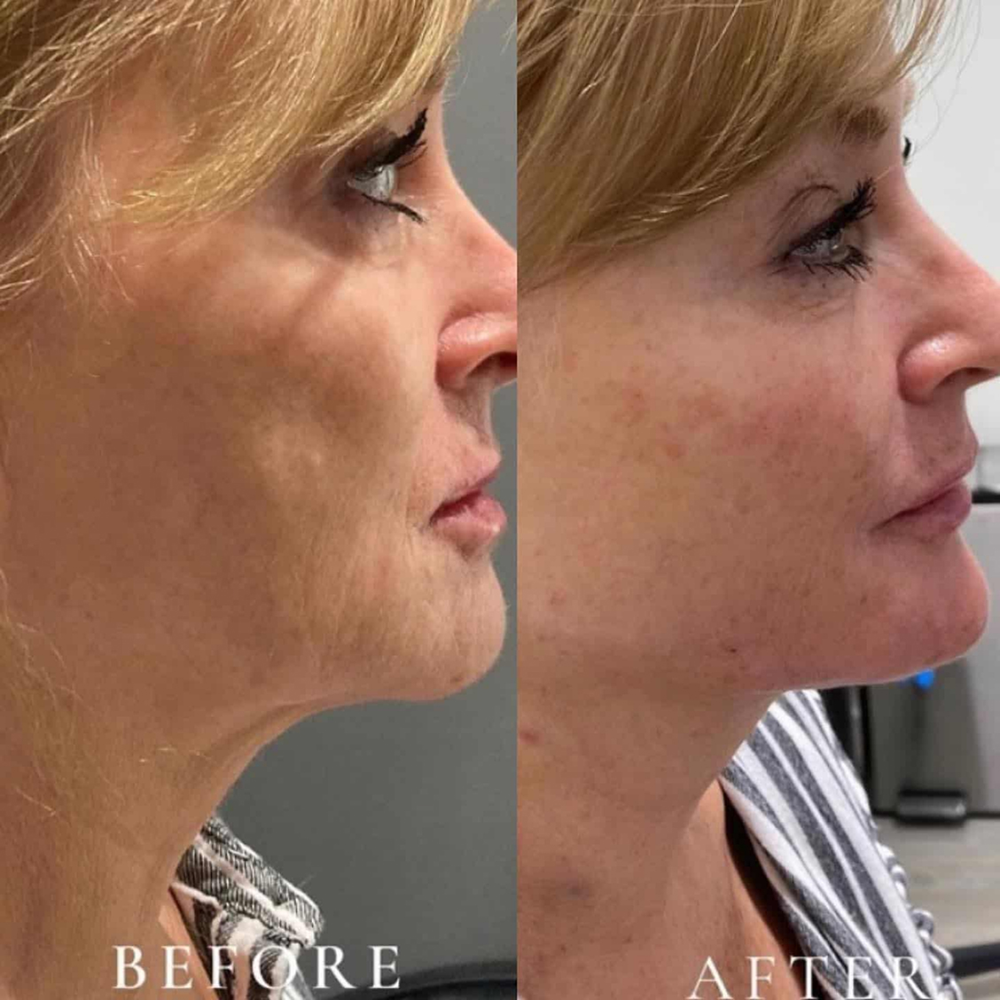 benson_pa_1668021804_2967904463549270032_1121674919