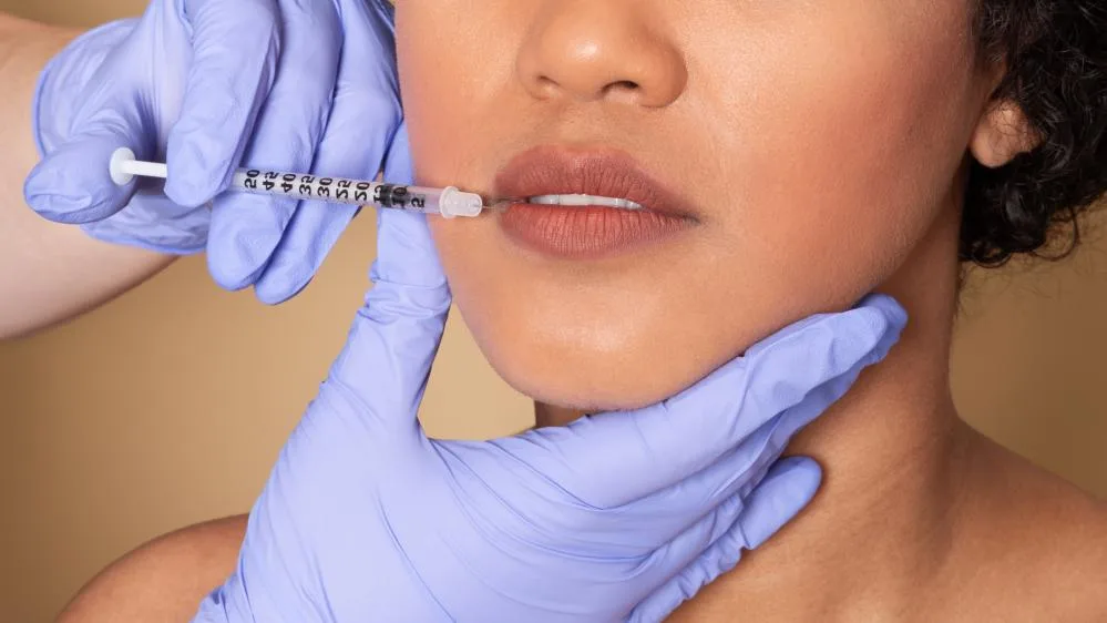 Benefits of Lip Injections