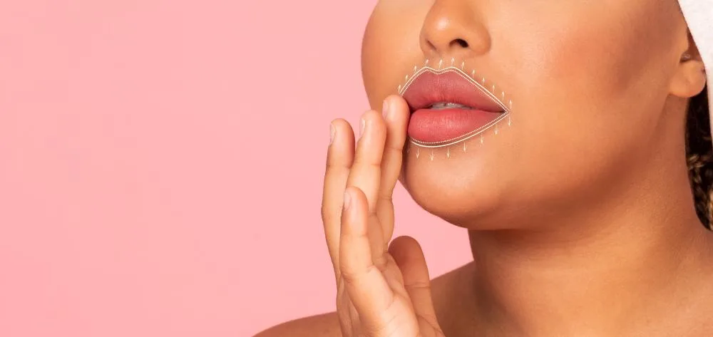 What to Expect During a Lip Filler Procedure